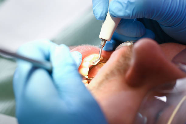 Best Emergency Treatment for Toothache in Waipio, HI
